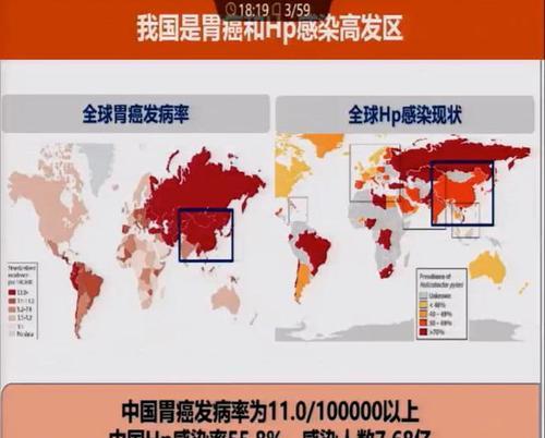 探寻《HP无上荣光》的攻略秘籍（揭秘游戏关卡、解锁技巧、获得宝藏，带你成为游戏王者！）
