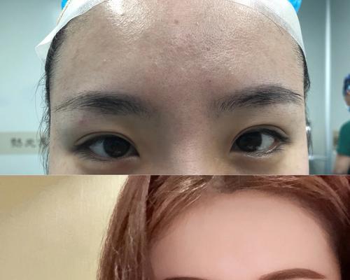 以芭比为主题的脑部手术攻略（用芭比娃娃进行脑部手术的详细步骤及技巧）