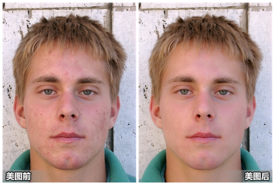 美图秀秀2015如何磨皮祛痘 美图秀秀照片美容图文教程