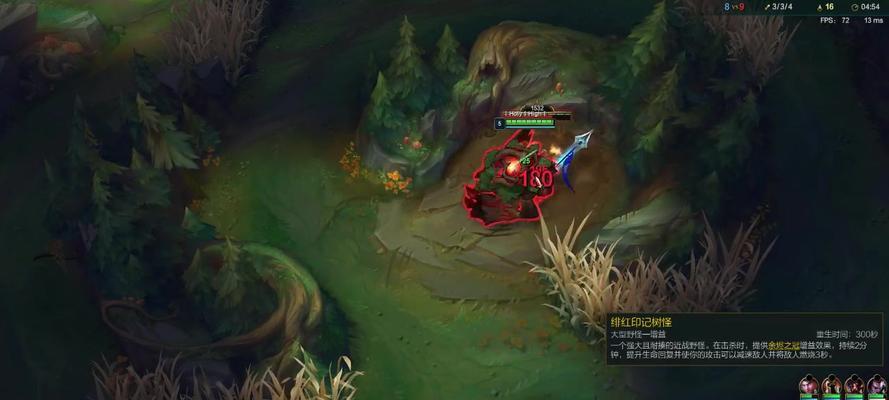 无限火力佐伊出装攻略（打造最强无限火力！佐伊出装技巧与策略大揭秘）