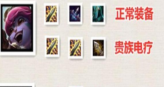 《天选福星基兰出装攻略》（掌握关键装备提升基兰实力）